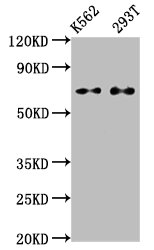 ATF2 Antibody – Figure 1 of 2