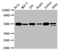 ATF4 Antibody – Figure 1 of 5