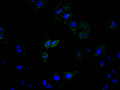 Immunofluorescence staining of Hela cell with CSB-RA002415MA1HU at 1:100, counter-stained with DAPI. The cells were fixed in 4% formaldehyde and blocked in 10% normal Goat Serum. The cells were then incubated with the antibody overnight at 4C. The secondary antibody was Alexa Fluor 488-congugated AffiniPure Goat Anti-Rabbit IgG(H+L) .