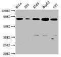 Western Blot
Positive WB detected in: Hela whole cell lysate, 293 whole cell lysate, A549 whole cell lysate, HepG2 whole cell lysate, U87 whole cell lysate
All lanes: BAG3 antibody at 0.73μg/ml
Secondary
Goat polyclonal to rabbit IgG at 1/50000 dilution
Predicted band size: 62 KDa
Observed band size: 80 KDa