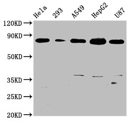 Western Blot
Positive WB detected in: Hela whole cell lysate, 293 whole cell lysate, A549 whole cell lysate, HepG2 whole cell lysate, U87 whole cell lysate
All lanes: BAG3 antibody at 0.73μg/ml
Secondary
Goat polyclonal to rabbit IgG at 1/50000 dilution
Predicted band size: 62 KDa
Observed band size: 80 KDa