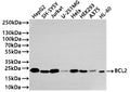 Western Blot
Positive WB detected in: HepG2 whole cell lysate(20µg) , SH-SY5Y whole cell lysate(20µg) , Jurkat whole cell lysate(20µg) , U-251MG whole cell lysate(20µg) , HeLa whole cell lysate(20µg) , HEK293 whole cell lysate(20µg) , A375 whole cell lysate(20µg) , HL-60 whole cell lysate(20µg) 
All lanes: BCL2 antibody at 1:1000
Secondary
Goat polyclonal to rabbit IgG at 1/40000 dilution
Predicted band size: 26 kDa
Observed band size: 26 kDa
Exposure time：2min