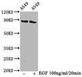 Western Blot
Positive WB detected in A549 whole cell lysate(treated with EGF or not) 
All lanes Phospho-BRAF antibody at 1.3μg/ml
Secondary
Goat polyclonal to rabbit IgG at 1/50000 dilution
Predicted band size: 85 KDa
Observed band size: 85 KDa