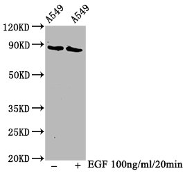 Western Blot
Positive WB detected in A549 whole cell lysate(treated with EGF or not) 
All lanes Phospho-BRAF antibody at 1.3μg/ml
Secondary
Goat polyclonal to rabbit IgG at 1/50000 dilution
Predicted band size: 85 KDa
Observed band size: 85 KDa
