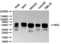 Western Blot
Positive WB detected in: Hela whole cell lysate(30µg), A431 whole cell lysate(30µg),  HEK293 whole cell lysate(30µg),colo205 whole cell lysate(30µg),786-O whole cell lysate(30µg)
All lanes: BSG antibody at 1:1000
Secondary
Goat polyclonal to human IgG at 1/40000 dilution
Predicted band size: 42.200,29.221,19.438,22.764 kDa
Observed band size: 55 kDa
Exposure time: 120s