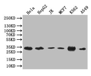 Western Blot
Positive WB detected in: Hela whole cell lysate, HepG2 whole cell lysate, JK whole cell lysate, MCF7 whole cell lysate, K562 whole cell lysate, A549 whole cell lysate
All lanes: Caspase 3 antibody at 1:1000
Secondary
Goat polyclonal to rabbit IgG at 1/50000 dilution
Predicted band size: 32 kDa
Observed band size: 32 kDa