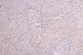 IHC image of CSB-RA003657MA1HU diluted at 1:100 and staining in paraffin-embedded human liver tissue performed on a Leica BondTM system. After dewaxing and hydration, antigen retrieval was mediated by high pressure in a citrate buffer (pH 6.0) . Section was blocked with 10% normal goat serum 30min at RT. Then primary antibody (1% BSA) was incubated at 4°C overnight. The primary is detected by a Goat anti-Human IgG labeled by HRP and visualized using 0.05% DAB.