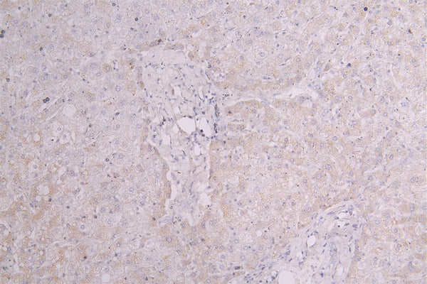 IHC image of CSB-RA003657MA1HU diluted at 1:100 and staining in paraffin-embedded human liver tissue performed on a Leica BondTM system. After dewaxing and hydration, antigen retrieval was mediated by high pressure in a citrate buffer (pH 6.0) . Section was blocked with 10% normal goat serum 30min at RT. Then primary antibody (1% BSA) was incubated at 4°C overnight. The primary is detected by a Goat anti-Human IgG labeled by HRP and visualized using 0.05% DAB.