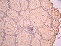 IHC image of CSB-RA004434MA1HU diluted at 1:50 and staining in paraffin-embedded human thyroid tissue performed on a Leica BondTM system. After dewaxing and hydration, antigen retrieval was mediated by high pressure in a citrate buffer (pH 6.0). Section was blocked with 10% normal goat serum 30min at RT. Then primary antibody (1% BSA) was incubated at 4°C overnight. The primary is detected by a Anti-Human lgG, Fcy Fragment Specific labeled by HRP and visualized using 0.05% DAB.