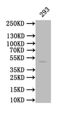 Western Blot
Positive WB detected in: 293 whole cell lysate
All lanes: CALR antibody at 1:1000
Secondary
Goat polyclonal to mouse IgG at 1/50000 dilution
Predicted band size: 49 kDa
Observed band size: 49 kDa
