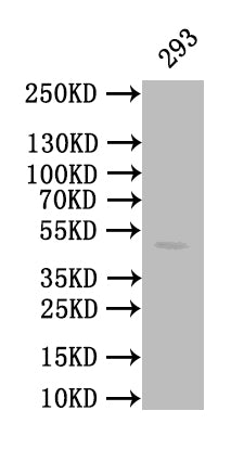 Western Blot
Positive WB detected in: 293 whole cell lysate
All lanes: CALR antibody at 1:1000
Secondary
Goat polyclonal to mouse IgG at 1/50000 dilution
Predicted band size: 49 kDa
Observed band size: 49 kDa