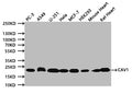 Western Blot
Positive WB detected in:PC-3 whole cell lysate (20µg) , A549 whole cell lysate (20µg) , U251 whole cell lysate (20µg) , Hela whole cell lysate (20µg) , MCF-7 whole cell lysate (20µg) , HEK293 whole cell lysate (20µg) ,  Mouse Heart tissue lysate (20µg) , Rat Heart tissue lysate (20µg) 
All lanes: CAV1 antibody at 1:500
Secondary
Goat polyclonal to mouse IgG at 1/50000 dilution
Predicted band size:20 kDa
Observed band size:20 kDa
Exposure time:120s