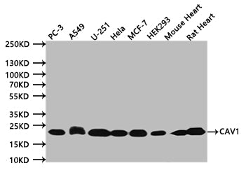 Western Blot
Positive WB detected in:PC-3 whole cell lysate (20µg) , A549 whole cell lysate (20µg) , U251 whole cell lysate (20µg) , Hela whole cell lysate (20µg) , MCF-7 whole cell lysate (20µg) , HEK293 whole cell lysate (20µg) ,  Mouse Heart tissue lysate (20µg) , Rat Heart tissue lysate (20µg) 
All lanes: CAV1 antibody at 1:500
Secondary
Goat polyclonal to mouse IgG at 1/50000 dilution
Predicted band size:20 kDa
Observed band size:20 kDa
Exposure time:120s