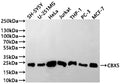 Western Blot
Positive WB detected in: SH-SY5Y whole cell lysate(30µg), U-251MG whole cell lysate(30µg), HeLa whole cell lysate(30µg), Jurkat whole cell lysate(30µg), THP-1 whole cell lysate(30µg), PC-3 whole cell lysate(30µg), MCF-7 whole cell lysate(30µg)
All lanes: CBX5 antibody at 1:1000
Secondary
Goat polyclonal to human IgG at 1/40000 dilution
Predicted band size: 22 kDa
Observed band size: 22 kDa
Exposure time: 2min