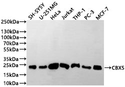 Western Blot
Positive WB detected in: SH-SY5Y whole cell lysate(30µg), U-251MG whole cell lysate(30µg), HeLa whole cell lysate(30µg), Jurkat whole cell lysate(30µg), THP-1 whole cell lysate(30µg), PC-3 whole cell lysate(30µg), MCF-7 whole cell lysate(30µg)
All lanes: CBX5 antibody at 1:1000
Secondary
Goat polyclonal to human IgG at 1/40000 dilution
Predicted band size: 22 kDa
Observed band size: 22 kDa
Exposure time: 2min
