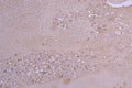 CCL2 Recombinant Monoclonal Antibody – Figure 1 of 1