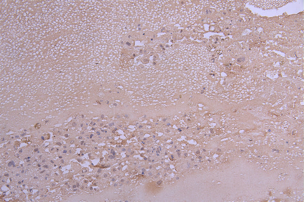 CCL2 Recombinant Monoclonal Antibody – Figure 1 of 1