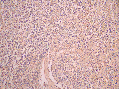 IHC image of CSB-RA004793MA1HU diluted at 1:50 and staining in paraffin-embedded human lymph node tissue performed on a Leica BondTM system. After dewaxing and hydration, antigen retrieval was mediated by high pressure in a citrate buffer (pH 6.0). Section was blocked with 10% normal goat serum 30min at RT. Then primary antibody (1% BSA) was incubated at 4°C overnight. The primary is detected by a Anti-Human lgG, Fcy Fragment Specific labeled by HRP and visualized using 0.05% DAB.