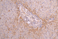 IHC image of CSB-RA004879MA1HU diluted at 1：100 and staining in paraffin-embedded human liver tissue performed on a Leica BondTM system. After dewaxing and hydration, antigen retrieval was mediated by high pressure in a citrate buffer (pH 6.0) . Section was blocked with 10% normal goat serum 30min at RT. Then primary antibody (1% BSA) was incubated at 4°C overnight. The primary is detected by a Goat anti-human polymer IgG labeled by HRP and visualized using 0.05% DAB.