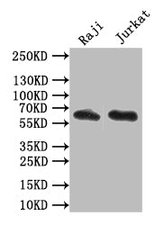 Western Blot
Positive WB detected in: Raji whole cell lysate,JK whole cell lysate
All lanes: CD19 antibody at 1:1000
Secondary
Goat polyclonal to mouse IgG at 1/50000 dilution
Predicted band size: 62 kDa
Observed band size: 62 kDa