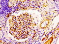 IHC image of CSB-RA004926A0HU diluted at 1:100 and staining in paraffin-embedded human kidney tissue performed on a Leica BondTM system. After dewaxing and hydration, antigen retrieval was mediated by high pressure in a citrate buffer (pH 6.0) . Section was blocked with 10% normal goat serum 30min at RT. Then primary antibody (1% BSA) was incubated at 4℃ overnight. The primary is detected by a biotinylated secondary antibody and visualized using an HRP conjugated SP system.