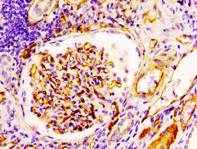 IHC image of CSB-RA004926A0HU diluted at 1:100 and staining in paraffin-embedded human kidney tissue performed on a Leica BondTM system. After dewaxing and hydration, antigen retrieval was mediated by high pressure in a citrate buffer (pH 6.0) . Section was blocked with 10% normal goat serum 30min at RT. Then primary antibody (1% BSA) was incubated at 4℃ overnight. The primary is detected by a biotinylated secondary antibody and visualized using an HRP conjugated SP system.