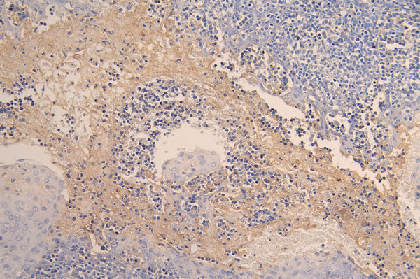 IHC image of CSB-RA004928MA1HU diluted at 1:200 and staining in paraffin-embedded human tonsil tissue performed on a Leica BondTM system. After dewaxing and hydration, antigen retrieval was mediated by high pressure in a citrate buffer (pH 6.0) . Section was blocked with 10% normal goat serum 30min at RT. Then primary antibody (1% BSA) was incubated at 4°C overnight. The primary is detected by a Goat anti-human polymer IgG labeled by HRP and visualized using 0.05% DAB.