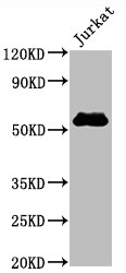 Western Blot
Positive WB detected in Jurkat whole cell lysate
All lanes CD4 antibody at 0.8μg/ml
Secondary
Goat polyclonal to rabbit IgG at 1/50000 dilution
Predicted band size: 55 KDa
Observed band size: 55 KDa