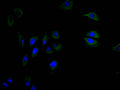 Immunofluorescence staining of A549 cell with CSB-RA004936MA1HU at 1:30,  counter-stained with DAPI. The cells were fixed in 4% formaldehyde and blocked in 10% normal Goat Serum. The cells were then incubated with the antibody overnight at 4C. The secondary antibody was FITC-conjugated AffiniPure Goat Anti-mouse IgG(H+L) .