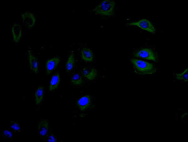 Immunofluorescence staining of A549 cell with CSB-RA004936MA1HU at 1:30,  counter-stained with DAPI. The cells were fixed in 4% formaldehyde and blocked in 10% normal Goat Serum. The cells were then incubated with the antibody overnight at 4C. The secondary antibody was FITC-conjugated AffiniPure Goat Anti-mouse IgG(H+L) .