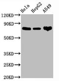 Western Blot
Positive WB detected in Hela whole cell lysate,HepG2 whole cell lysate,A549 whole cell lysate
All lanes CD44 antibody at 1.25μg/ml
Secondary
Goat polyclonal to rabbit IgG at 1/50000 dilution
Predicted band size: 82 KDa
Observed band size: 82 KDa