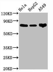 Western Blot
Positive WB detected in Hela whole cell lysate,HepG2 whole cell lysate,A549 whole cell lysate
All lanes CD44 antibody at 1.25μg/ml
Secondary
Goat polyclonal to rabbit IgG at 1/50000 dilution
Predicted band size: 82 KDa
Observed band size: 82 KDa