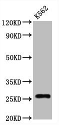 Western Blot
Positive WB detected in:K562 whole cell lysate
All lanes:CD81 antibody at 1.25μg/ml
Secondary
Goat polyclonal to rabbit IgG at 1/50000 dilution
Predicted band size: 26 KDa
Observed band size: 26 KDa