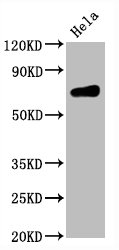Western Blot
Positive WB detected in Hela whole cell lysate
All lanes CD86 antibody at 0.55μg/ml
Secondary
Goat polyclonal to rabbit IgG at 1/50000 dilution
Predicted band size: 70 KDa
Observed band size: 70 KDa