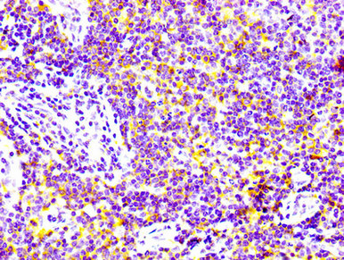 IHC image of CSB-RA004972A0HU diluted at 1:100 and staining in paraffin-embedded human lymph node tissue performed on a Leica BondTM system. After dewaxing and hydration, antigen retrieval was mediated by high pressure in a citrate buffer (pH 6.0) . Section was blocked with 10% normal goat serum 30min at RT. Then primary antibody (1% BSA) was incubated at 4℃ overnight. The primary is detected by a biotinylated secondary antibody and visualized using an HRP conjugated SP system.