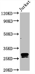 Western Blot
Positive WB detected in Jurkat whole cell lysate
All lanes CD99 antibody at 0.8μg/ml
Secondary
Goat polyclonal to rabbit IgG at 1/50000 dilution
Predicted band size: 28 KDa
Observed band size: 28 KDa