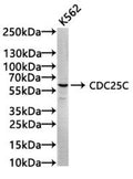 Western Blot
Positive WB detected in: Hela whole cell lysate, K562 whole cell lysate, Raji whole cell lysate, 293 whole cell lysate
All lanes: Cdc25C antibody at 1.65μg/ml
Secondary
Goat polyclonal to rabbit IgG at 1/50000 dilution
Predicted band size: 54, 52, 49, 46 KDa
Observed band size: 60 KDa