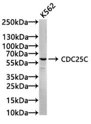 Western Blot
Positive WB detected in: Hela whole cell lysate, K562 whole cell lysate, Raji whole cell lysate, 293 whole cell lysate
All lanes: Cdc25C antibody at 1.65μg/ml
Secondary
Goat polyclonal to rabbit IgG at 1/50000 dilution
Predicted band size: 54, 52, 49, 46 KDa
Observed band size: 60 KDa
