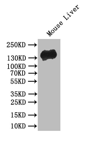 Western Blot
Positive WB detected in: Mouse Liver tissue lysate
All lanes: CDH1 antibody at 1:500
Secondary
Goat polyclonal to mouse IgG at 1/50000 dilution
Predicted band size: 80-135 kDa
Observed band size: 135 kDa
