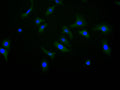 Immunofluorescence staining of Hela cell with CSB-RA005036MA1HU at 1:10, counter-stained with DAPI. The cells were fixed in 4% formaldehyde and blocked in 10% normal Goat Serum. The cells were then incubated with the antibody overnight at 4C. The secondary antibody was FITC-conjugated AffiniPure Goat Anti-Human IgG(H+L) .