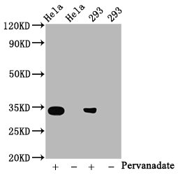 Western BlotPositive WB detected in:Hela whole cell lysate, 293 whole cell lysate(treated with Pervanadate or not) All lanes:Phospho-CDK2 antibody at 0.8μg/mlSecondaryGoat polyclonal to rabbit IgG at 1/50000 dilutionPredicted band size: 34 KDaObserved band size: 34 KDa