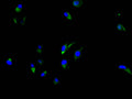 CEACAM5 Recombinant Monoclonal Antibody – Figure 1 of 3