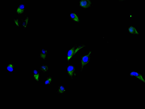 CEACAM5 Recombinant Monoclonal Antibody – Figure 1 of 3