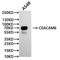 Western Blot
Positive WB detected in:  A549 whole cell lysate(30µg)
All lanes: CEACAM6 antibody at 1:1000
Secondary
Goat polyclonal to human IgG at 1/40000 dilution
Predicted band size: 37 kDa
Observed band size: 70 kDa
Exposure time: 60s