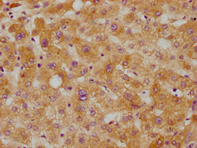 IHC image of CSB-RA005267A0HU diluted at 1:115 and staining in paraffin-embedded human liver tissue performed on a Leica BondTM system. After dewaxing and hydration, antigen retrieval was mediated by high pressure in a citrate buffer (pH 6.0) . Section was blocked with 10% normal goat serum 30min at RT. Then primary antibody (1% BSA) was incubated at 4℃ overnight. The primary is detected by a biotinylated secondary antibody and visualized using an HRP conjugated SP system.