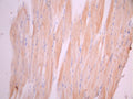 IHC image of CSB-RA005386MA1HU diluted at 1:50 and staining in paraffin-embedded human skeletal muscle tissue performed on a Leica BondTM system. After dewaxing and hydration, antigen retrieval was mediated by high pressure in a citrate buffer (pH 6.0). Section was blocked with 10% normal goat serum 30min at RT. Then primary antibody (1% BSA) was incubated at 4°C overnight. The primary is detected by a Anti-Human lgG, Fcy Fragment Specific labeled by HRP and visualized using 0.05% DAB.