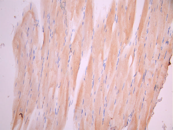 IHC image of CSB-RA005386MA1HU diluted at 1:50 and staining in paraffin-embedded human skeletal muscle tissue performed on a Leica BondTM system. After dewaxing and hydration, antigen retrieval was mediated by high pressure in a citrate buffer (pH 6.0). Section was blocked with 10% normal goat serum 30min at RT. Then primary antibody (1% BSA) was incubated at 4°C overnight. The primary is detected by a Anti-Human lgG, Fcy Fragment Specific labeled by HRP and visualized using 0.05% DAB.