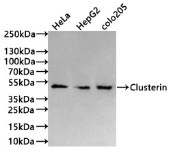 Western Blot
Positive WB detected in: HeLa whole cell lysate(30µg) , HepG2 whole cell lysate(30µg) , colo205 whole cell lysate(30µg) 
All lanes: Clusterin antibody at 1:1000
Secondary
Goat polyclonal to human IgG at 1/40000 dilution
Predicted band size: 52 kDa
Observed band size: 52 kDa
Exposure time: 30s