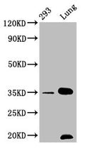 Western Blot
Positive WB detected in: 293 whole cell lysate, Mouse lung tissue
All lanes: CNN1 antibody at 1.05μg/ml
Secondary
Goat polyclonal to rabbit IgG at 1/50000 dilution
Predicted band size: 34, 32 KDa
Observed band size: 34 KDa