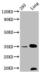 Western Blot
Positive WB detected in: 293 whole cell lysate, Mouse lung tissue
All lanes: CNN1 antibody at 1.05μg/ml
Secondary
Goat polyclonal to rabbit IgG at 1/50000 dilution
Predicted band size: 34, 32 KDa
Observed band size: 34 KDa